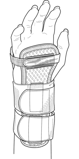 splint